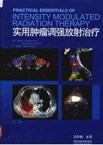 实用肿瘤调强放射治疗