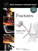 FRACTURES <em>THIRD</em> <em>EDITION</em>