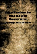 tumor prostheses <em>for</em> bone <em>and</em> joint reconstructionthe design <em>and</em> application