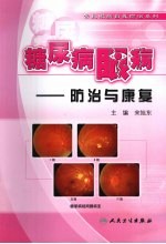 糖尿病眼病  <em>防治</em>与康复