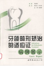 牙颌畸形矫治的适应症  病例展示