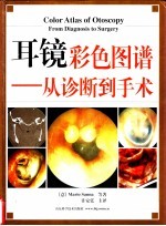 耳镜彩色图谱  从诊断到手术