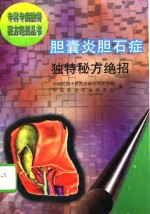 胆囊炎胆石症独特秘方绝招