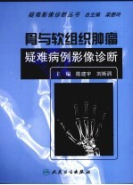 骨与软<em>组织</em><em>肿瘤</em>疑难病例影像诊断