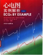 心电图实例解析  第2版