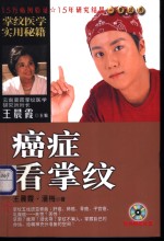 癌症看掌纹
