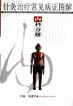针灸治疗常见病证图解  内科分册