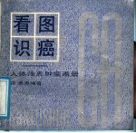 看图识癌  人体浅表肿瘤画册