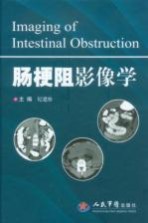 肠梗阻影像学