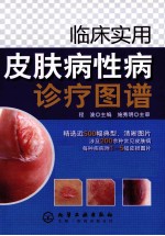<em>临床</em>实用皮肤病性病<em>诊疗</em>图谱