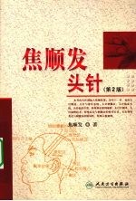<em>焦</em>顺发头针