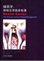 龋齿  疾病及其临床处理