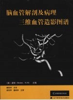 脑血管解剖<em>及</em><em>病理</em>三维血管造影图谱