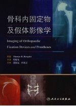 骨科内固定物及假体影像学