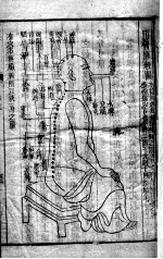 <em><em>黄帝</em><em>内经</em></em><em>素问</em>灵枢注证发微  卷3
