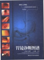 胃镜诊断图谱