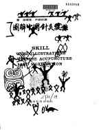 图解中国<em>针灸</em>技法