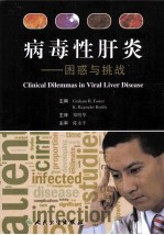 病毒性肝炎  困惑与挑战