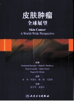皮肤肿瘤  全球展望