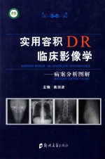 实用容积DR临床影像学  病案分析图解