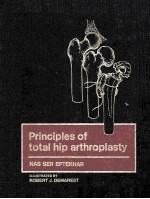 <em>principles</em> of total hip arthroplasty