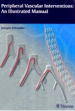 PERIPHERAL VASCULAR <em>IN</em>TERVENTIONS: AN ILLUSTRATED MANUAL