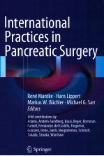 INTERNATIONAL PRACTICES IN PANCREATIC SUR<em>GE</em>RY