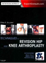 <em>TECHNIQUES</em> <em>IN</em> REVISION HIP <em>AND</em> KNEE ARTHROPLASTY