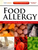 FOOD ALL<em>E</em><<em>e</em>m>R</<em>e</em>m>GY
