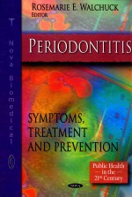 PERIODONTITI<em>S</em>  <em>S</em>YMPTOM<em>S</em>