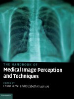 <em>The</em> <em>handbook</em> <em>of</em> medical image perception and techniques