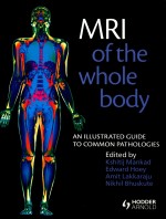 MRI <em>OF</em> THE WHOLE BODY  AN ILLUSTRATED GUIDE TO COMMON PATHOLOGIES