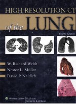 High-Resolution CT <em>of</em> the Lung <em>FOURTH</em> <em>EDITION</em>