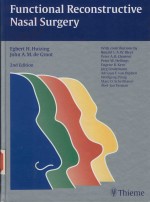 FUNCTIONAL RECONSTRUCTIVE NASAL <em>SURGERY</em> 2ND <em>EDITION</em>