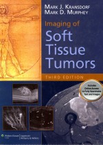 IMAG<em>IN</em>G <em>OF</em> S<em>OF</em>T TISSUE TUMORS THIRD <em>EDITION</em>