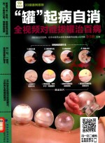 “罐”起病自消  全视频对症拔罐治百病