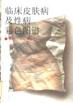 临床皮肤病及性病彩色图谱