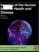 imag<em>in</em>g <em>of</em> the human bra<em>in</em> <em>in</em> health and disease