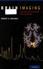 Brain ima<em>gi</em>n<em>g </em>w<em>ha</em>t it can (and cannot) tell us about consciousness