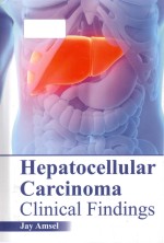 Hepatoce<em>l</em><em>l</em>u<em>l</em>ar carcinoma c<em>l</em>inica<em>l</em> findings