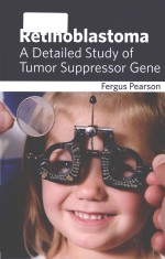 Retinobl<em>a</em>stom<em>a</em> <em>a</em> det<em>a</em>iled <em>study</em> <em>of</em> tumor suppressor gene