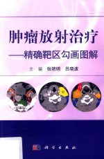 <em>肿瘤</em><em>放射</em><em>治疗</em>  精确靶区勾画图解