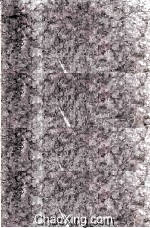 Mucous Colitis <em>A</em> Psychologic<em>a</em>l Medic<em>a</em>l <em>Study</em> <em>Of</em> Sixty C<em>a</em>ses