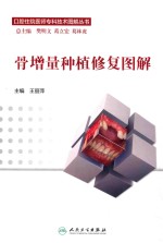 骨增量种植修复图解