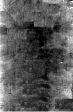 Di<em>s</em>ea<em>s</em>e<em>s</em> of <em>The</em> No<em>s</em>e