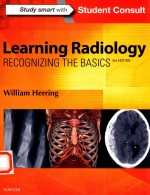 <em>LEARNING</em> RADIOIOGY RECOGNIZING THE BASICS
