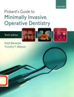 PICKARD'S GUIDE <em>T</em>O MINIMAIIY INVASIVE OPERA<em>T</em>IVE DEN<em>T</em>ISRY