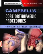 CAMPBE<em>L</em><em>L</em>'S CORE ORTHOPAEDIC PROCEDURES