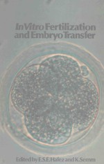 <em>IN</em> VITRO FERTILIZATION AND EMBRYO TRANSFER