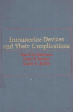 INTRAUTERINE DEVICES AND THEIR COMPLICATIONS